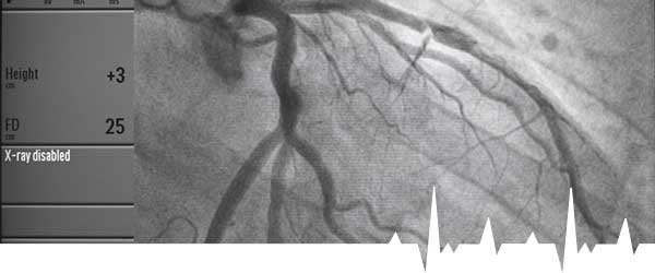 Cardiac Catheterisation/Coronary Angiogram